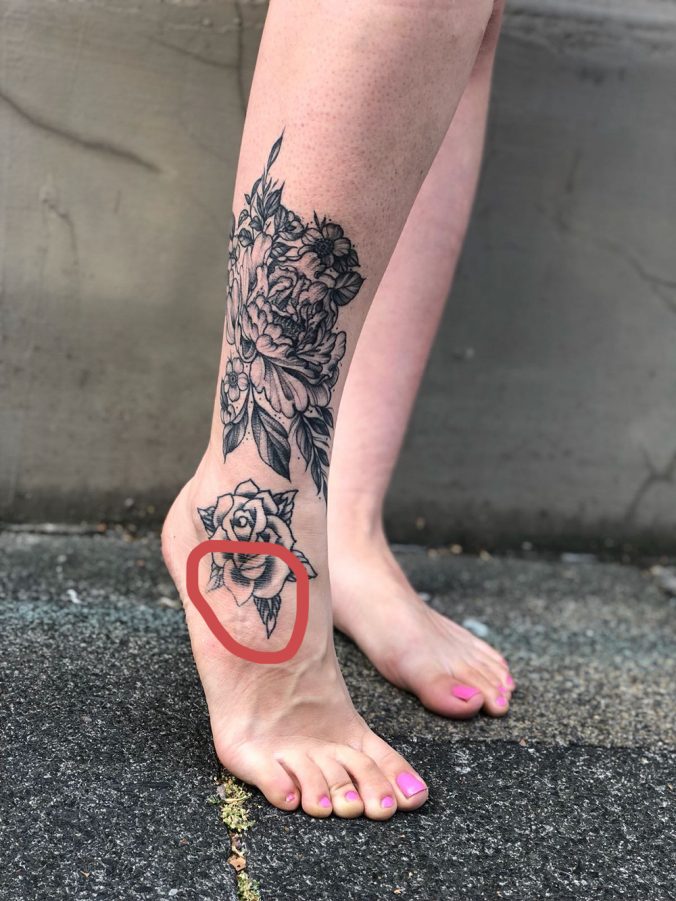Muss ich mein Tattoo nachstechen lassen? Zum Buntspecht Tattooblog